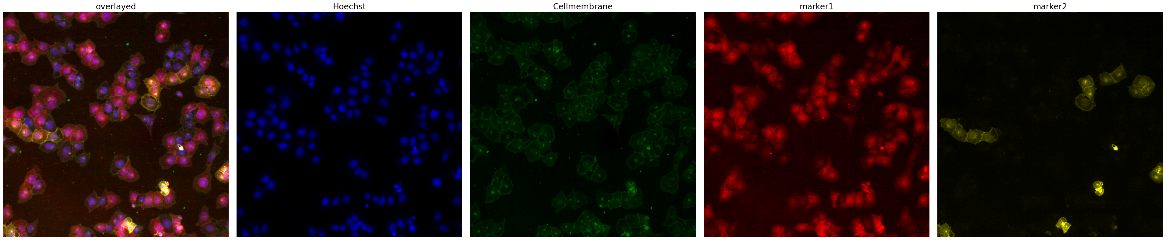 ../../_images/pages_notebooks__notebook_single_cell_extraction_configuration_5_1.png
